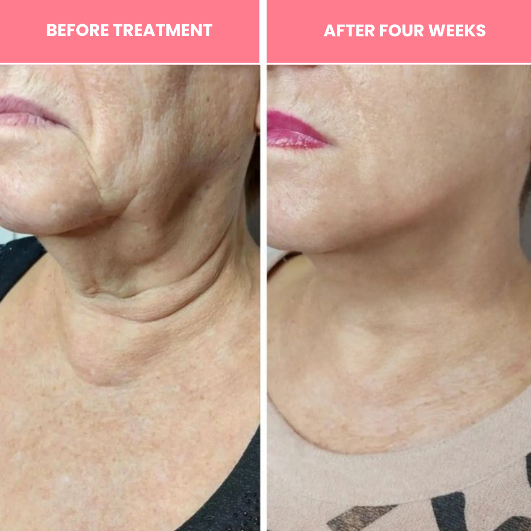 Korean Bio-Collagen Necklift Mask - Younger Neck After 1 Use