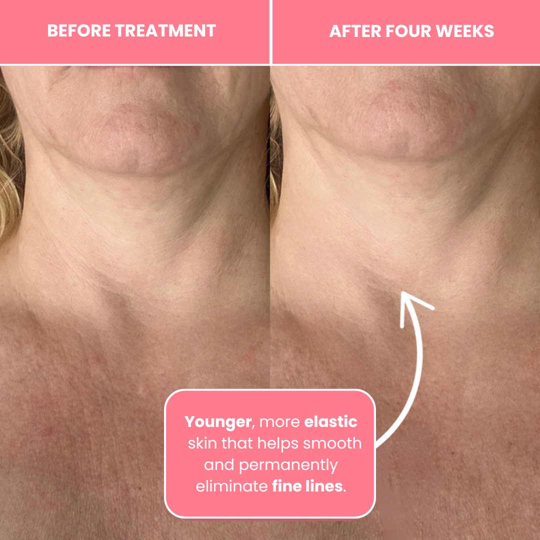 Korean Bio-Collagen Necklift Mask - Younger Neck After 1 Use