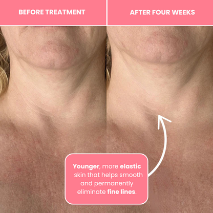 Korean Bio-Collagen Necklift Mask - Younger Neck After 1 Use